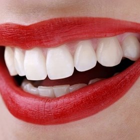 Best Teeth Whitening Strips: Shallen Paul